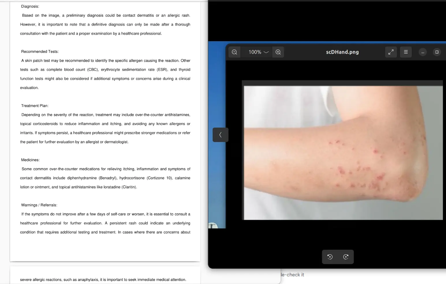 Medical Diagnosis Interface